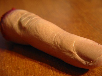 ��(g��)�Ԅ�(chu��ng)��Ѫ����ָU�P